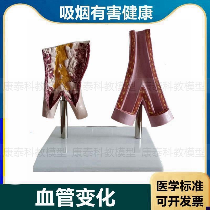 血管模型病理正常吸烟有害脏器心D脏口腔牙齿妊娠胎儿膀胱气管肺