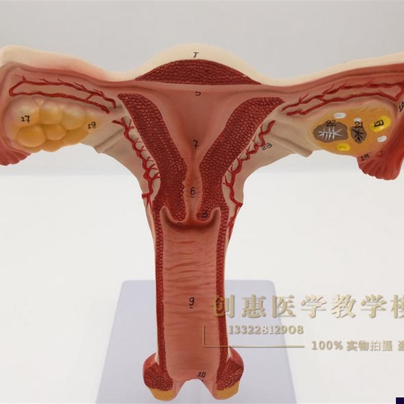 子宫解剖a模型 女性生殖系统计生教育演示器材 子宫模型厂家直销