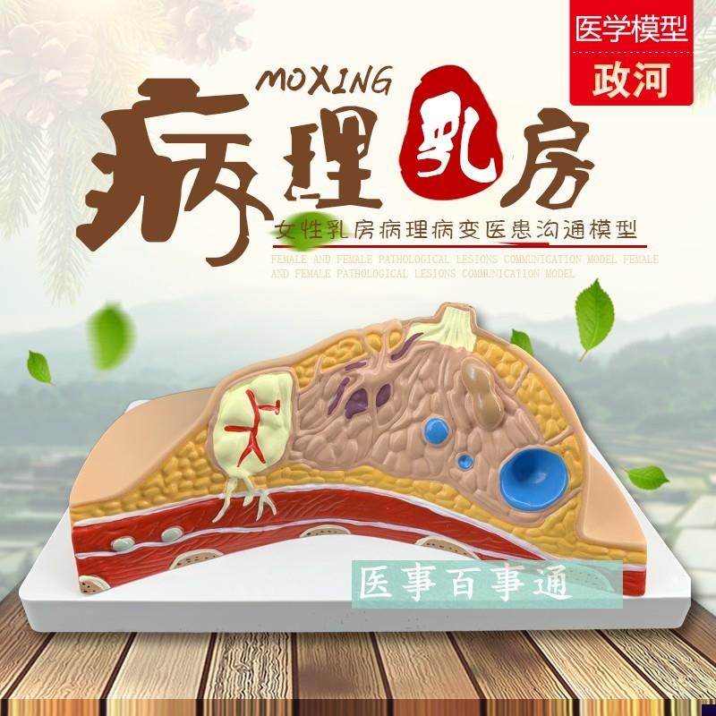 乳房模型解剖催乳培训健康教育生理生物生殖哺乳期W妇女用具器材