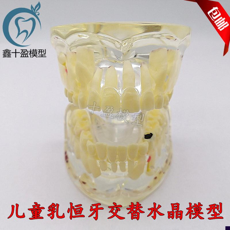 牙科口腔教学模型 儿童病理模型 乳牙恒牙交替 透Q明水晶模型M400