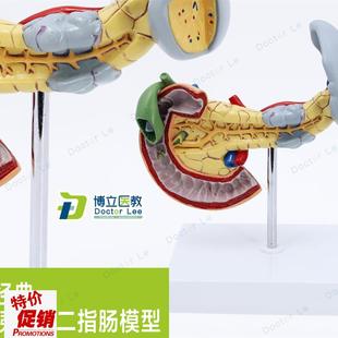 消化胰脏病变胰脾胆十二指肠模型进口模型人体病变内Z脏解剖模型