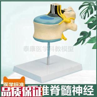 腰椎解剖模型椎管脊髓神经根蛛网膜软G脊膜麻醉科教学中枢周围神