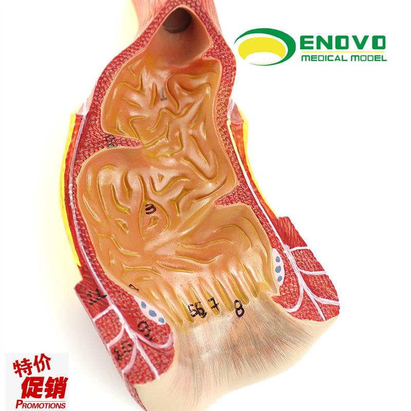ENOVO颐诺医学人体直肠w肛管肛门解剖结构模型肛肠科外科普外科