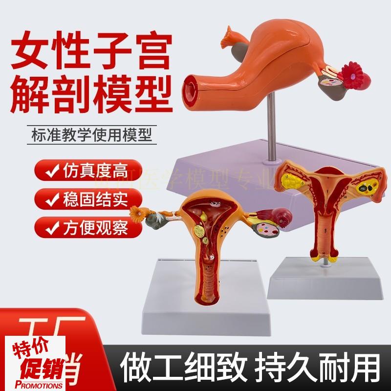 人体模型女性生殖子宫模型阴道卵C巢模型教学模具病理变化科学教