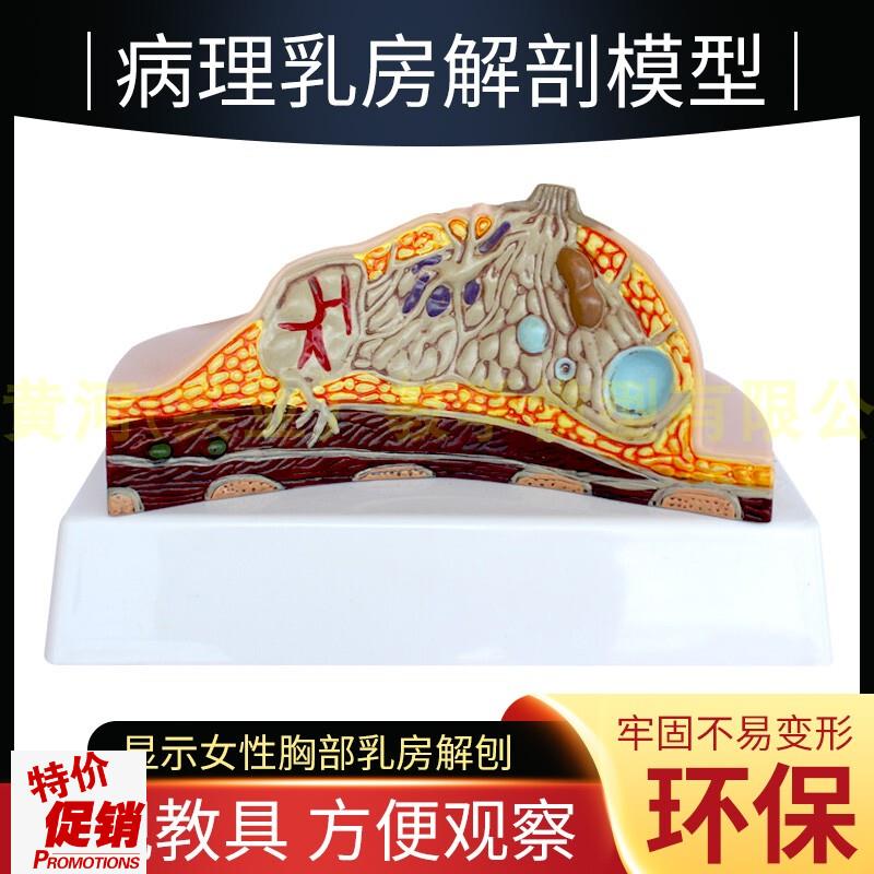 乳房模型胸部解剖模型静止期哺乳期E女性病变乳腺结构乳房医学教