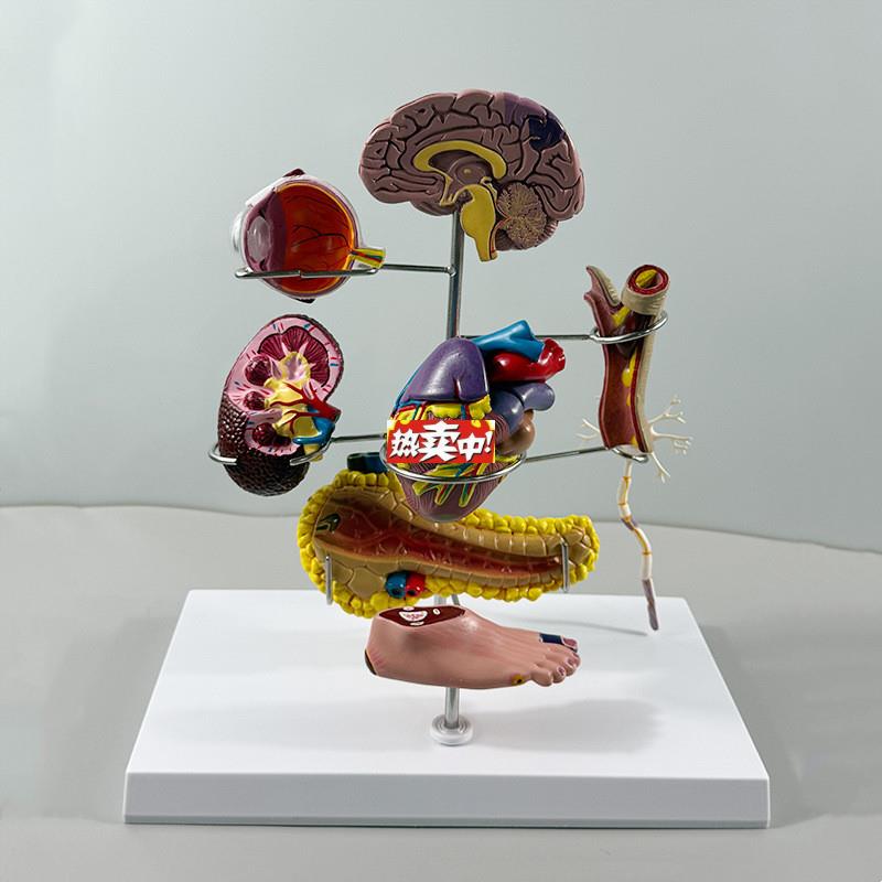 热销血糖模型糖尿并发内脏损伤心脑血管胰腺足y眼底视网膜内分泌