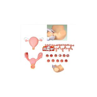 热销高级妇科综合检查训练模型宫腔d结构镜检查宫颈特