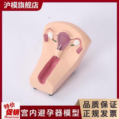 沪模女性b避孕练习模型子宫宫内避孕器及训练教具计划生育教育模