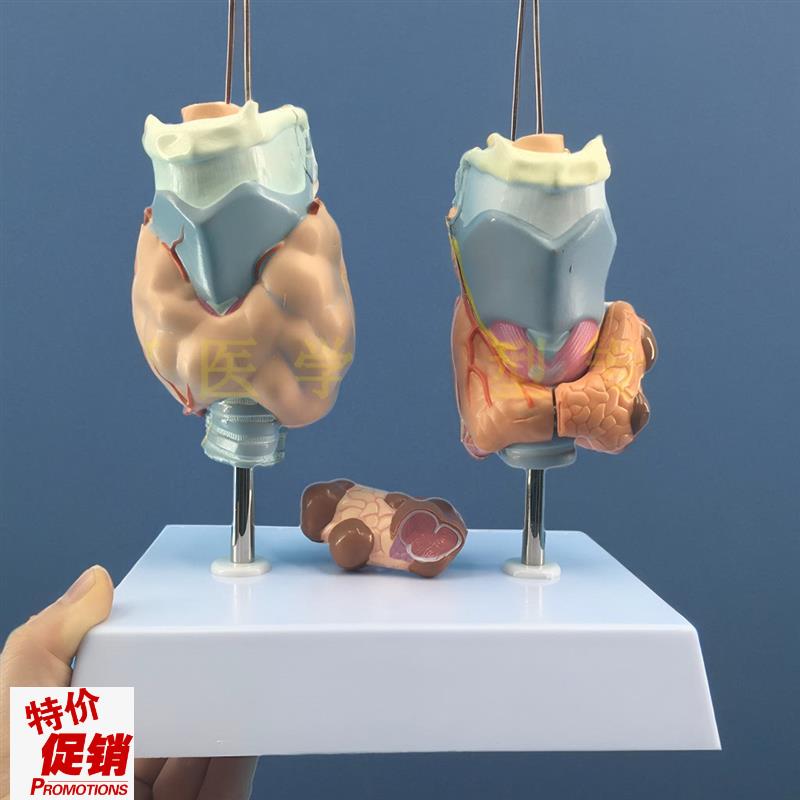 甲状腺病c变甲状腺病理模型甲亢甲低甲减人体内分泌系统模型