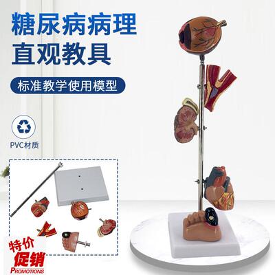 糖/尿病高/血压模型高血压病理变脑眼心脏肾脏S血管内脏模型G3