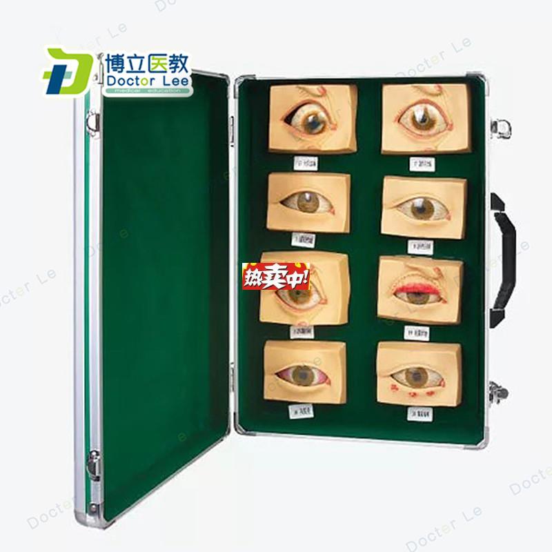 热销常见眼病模型20只/套p眼睛疾病模型眼模型眼睛病态模
