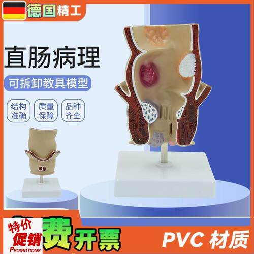 德国】人体直肠痔疮病变解剖模型结肠肛肠科Q肛门括约肌教学标本
