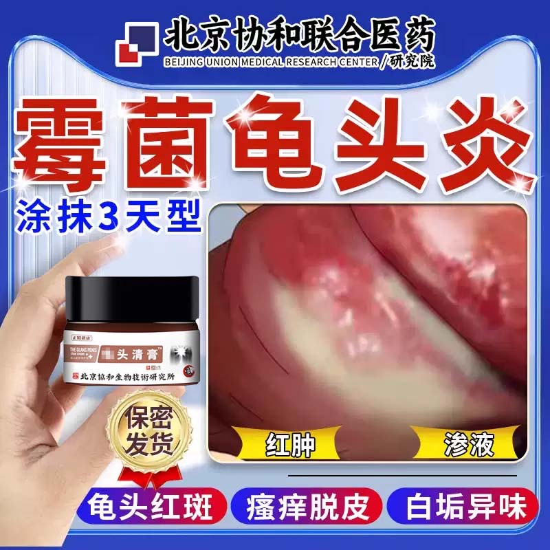 男性龜頭炎癥霉菌性包皮炎裂口治療男性私處專用真菌感染白垢藥膏