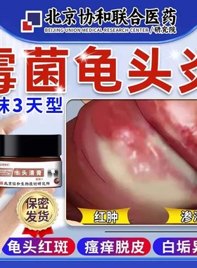 男性龟头炎症霉菌性包皮炎裂口治疗男性私处专用真菌感染白垢药膏