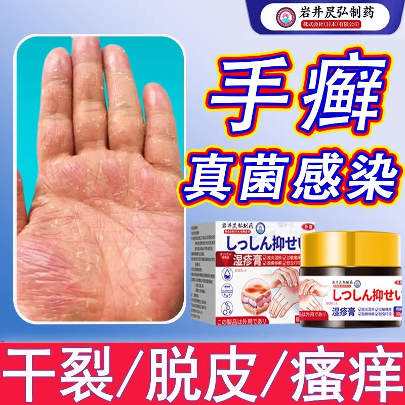 日本角化型湿疹手癣膏脱皮