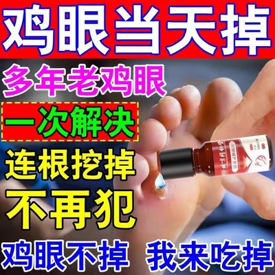 软化老茧去肉刺去鸡眼药水