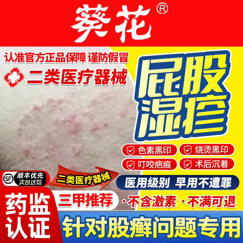 屁股湿疹屁股上长痘痘股藓痒起热