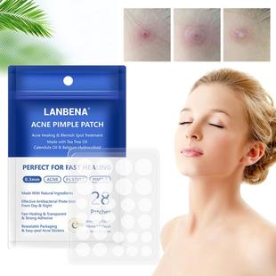 Treatment Patch Acne LANBENA Invi Use Scar Pimple Night