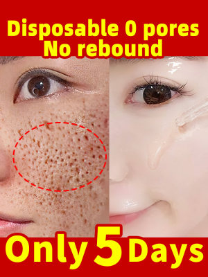 Pore Shrinking Serum Face Removing Large shrink Pores Tighte