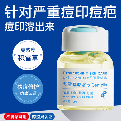 积雪草原液祛痘印修复淡化痘印痘坑痘疤去闭口粉刺收缩毛孔精华液
