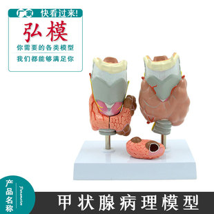 thyroid甲亢甲低人体甲状腺病理模型甲亢甲低 内分泌系统医学解剖