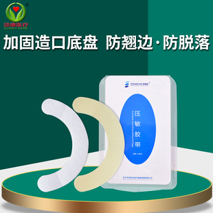 思泰利造口压敏胶带防翘边保护条水胶体水刺防漏贴环加固底盘粘贴