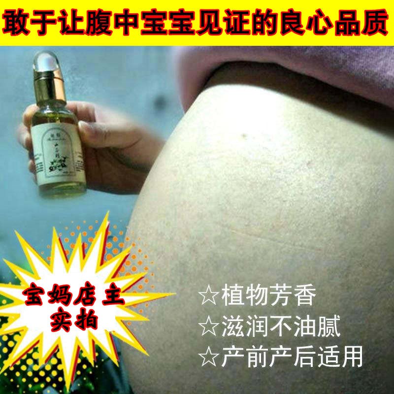 消除去除妊娠纹修复霜紧致壬辰产后预防哺乳期精油橄榄油护肤孕妇