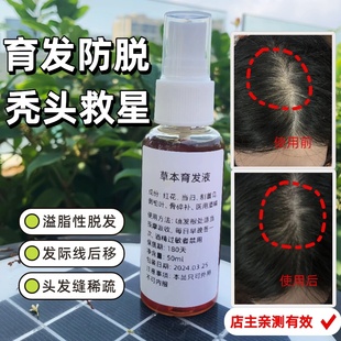 侧柏叶草本育发液脱发育发液增发密发际线防脱男女生发长头发