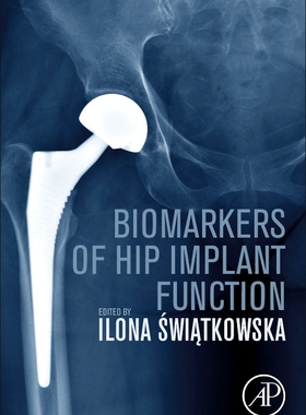 [预订]Biomarkers of Hip Implant Function