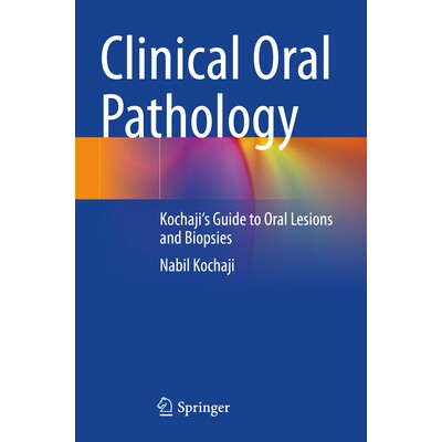 预订 Clinical Oral Pathology Kochaji’s Guide to Oral Lesions and Biopsies 临床口腔病理学:Kochaji口腔病变和活检指南 978