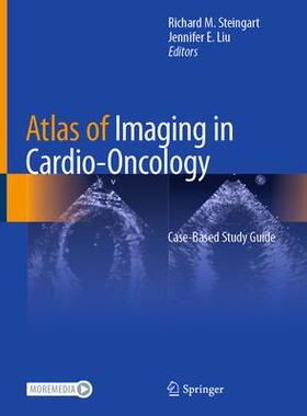 [预订]Atlas of Imaging in Cardio-Oncology 9783030709976