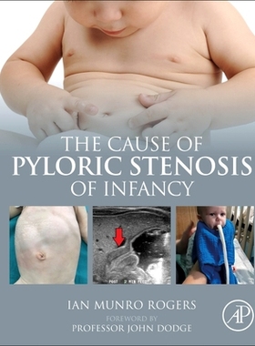 【预订】The Cause of Pyloric Stenosis of Infancy