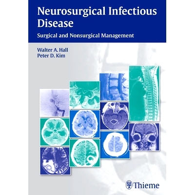 预订 Neurosurgical Infectious Disease: Surgical and Nonsurgical Management 神经外科传染病: 9781604068054
