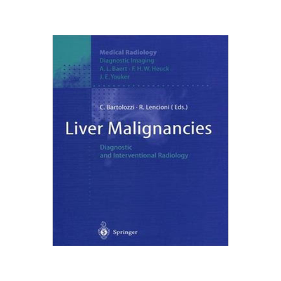 预订 Liver Malignancies