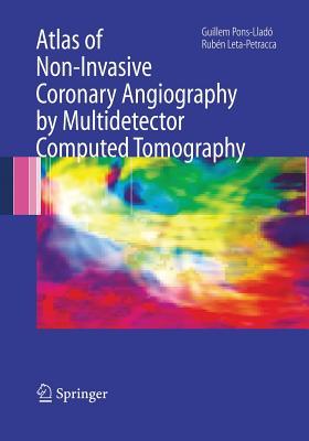 【预订】Atlas of Non-Invasive Coronary Angiography by Multidetector Computed Tomography