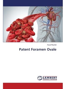 预订 Patent Foramen Ovale: 9783659832697