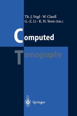 【预订】Computed Tomography
