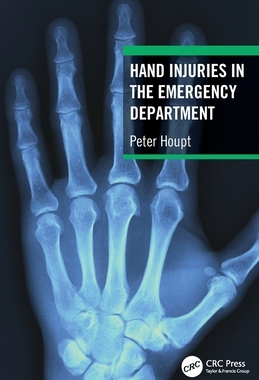 【预订】Hand Injuries in the Emergency Department 9781032322421