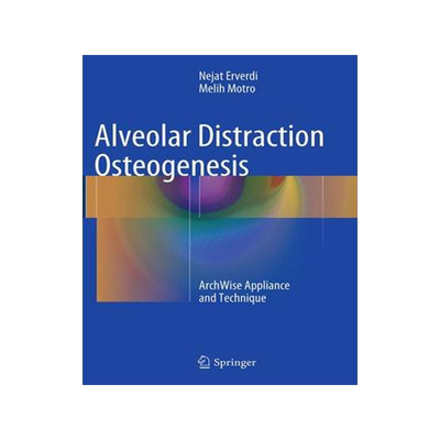 预订 Alveolar Distraction Osteogenesis