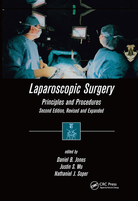 【预订】Laparoscopic Surgery