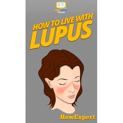 预订 How To Live With Lupus: Your Step By Step Guide To Living With Lupus: 9781647585501