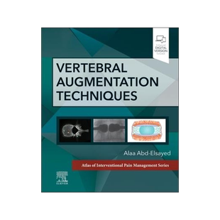 [预订]Vertebral Augmentation Techniques 9780323882262