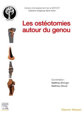 预订 Les ostéotomies autour du genou 膝盖周围截骨术: 9782294773648