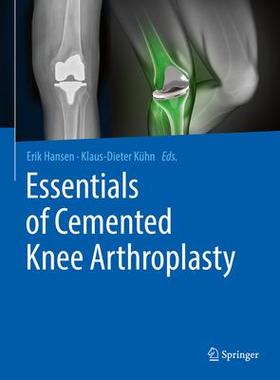 [预订]Essentials of Cemented Knee Arthroplasty 9783662631126