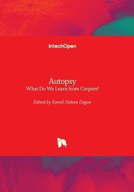[预订]Autopsy - What Do We Learn from Corpses? 9781803553399