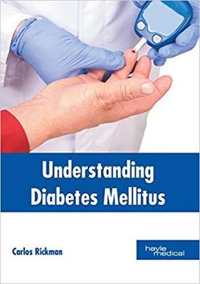 【预售】Understanding Diabetes Mellitus