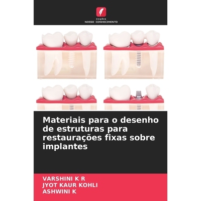 预订 Materiais para o desenho de estruturas para restaurações fixas sobre implantes: 9786130161149