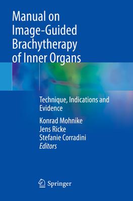 [预订]Manual on Image-Guided Brachytherapy of Inner Organs: Technique, Indications and Evidence 9783030780814