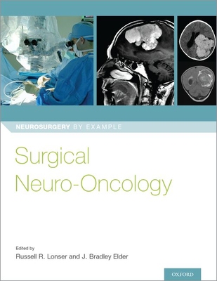 【预订】Surgical Neuro-Oncology