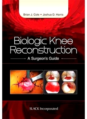 预订 Biologic Knee Reconstruction: A Surgeon’s Guide 生物膝盖再造: 9781617118166